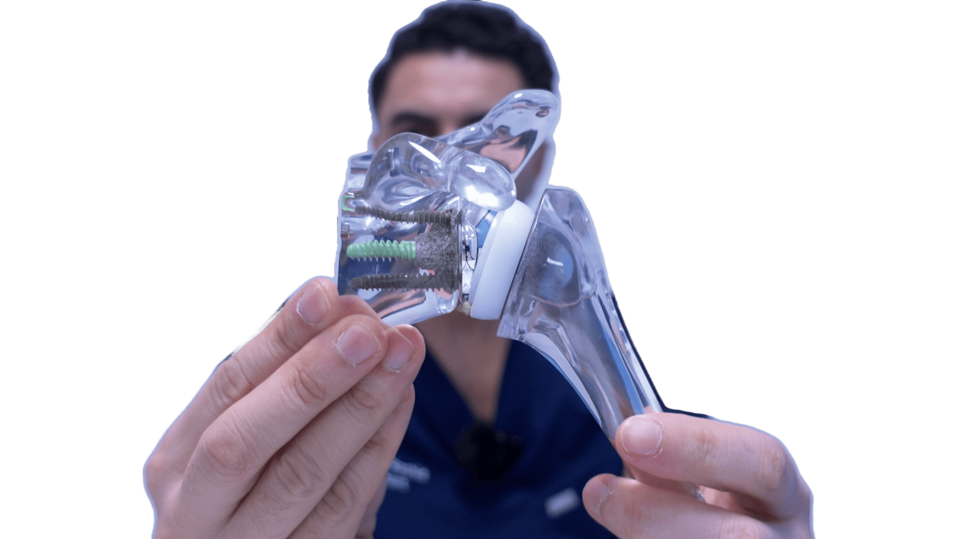 Reverse Total Shoulder Replacement